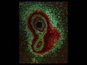 QSO0351 + 026 -   ,      ( )